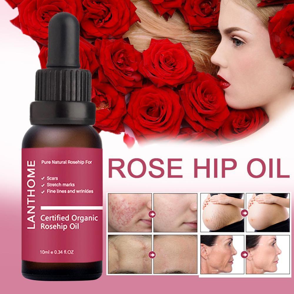 Pure Organic Rosehip Oil Antioxidantfor Scars Fine Lines Wrinkles Stretch Marks Improve Skin Elasticity Firmness - Virtual Blue Store