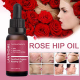 Pure Organic Rosehip Oil Antioxidantfor Scars Fine Lines Wrinkles Stretch Marks Improve Skin Elasticity Firmness - Virtual Blue Store
