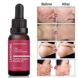 Pure Organic Rosehip Oil Antioxidantfor Scars Fine Lines Wrinkles Stretch Marks Improve Skin Elasticity Firmness - Virtual Blue Store