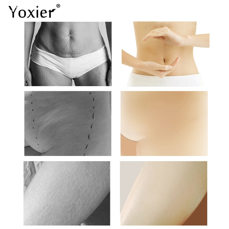 Yoxier Pearl Firming Body Lotion Slimming Cellulite Massage Remove Stretch Marks Cream Treatment Body Skin Care Health Lift Tool - Virtual Blue Store