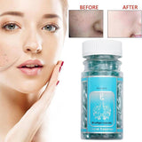 90 Pcs Aloe Vera Vitamin E Serum Face Care Capsule Cream Repair Ance Scar Anti Wrinkle Aging Moisturizing Whiten Brighten Skin - Virtual Blue Store