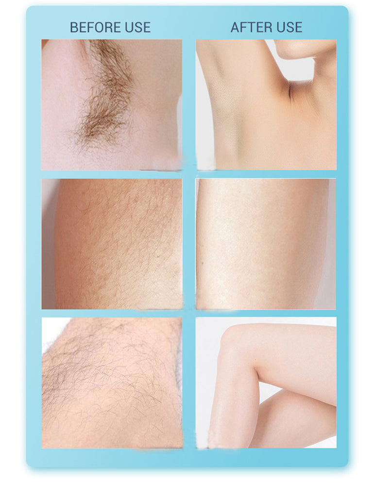 999999 Pulses Electric Laser Epilator Female Permanent Painless Ipl Laser Hair Removal Device Photoepilator  Epilator for Women - Virtual Blue Store