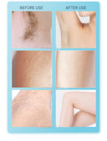 999999 Pulses Electric Laser Epilator Female Permanent Painless Ipl Laser Hair Removal Device Photoepilator  Epilator for Women - Virtual Blue Store
