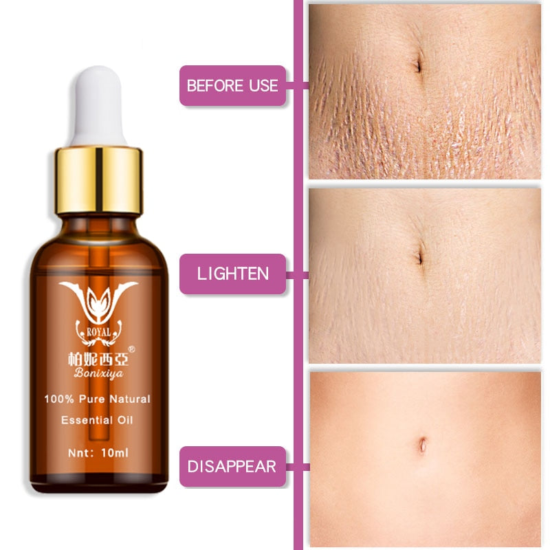 Stretch Marks Remover Essential Oil Eliminate Pregnancy Scars Maternity Repair Anti Winkle Skin Firming Treatment - Virtual Blue Store