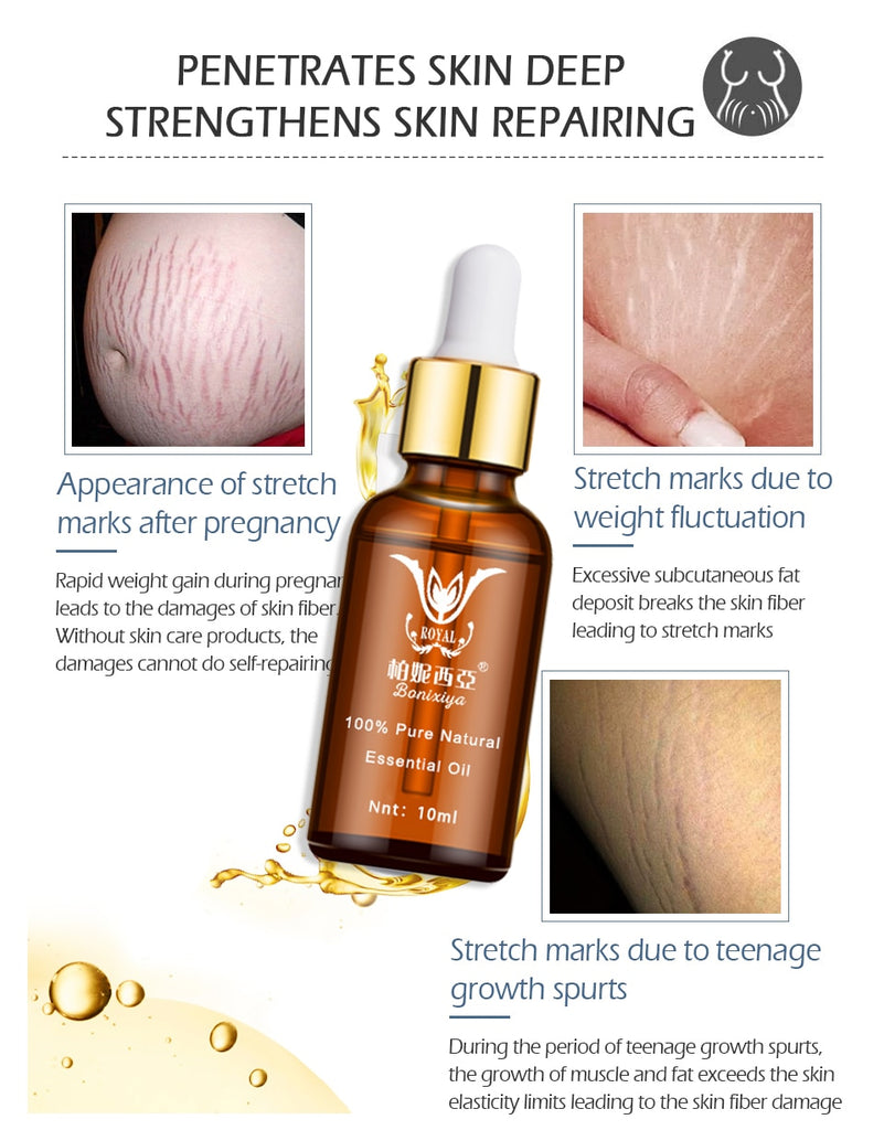 Stretch Marks Remover Essential Oil Eliminate Pregnancy Scars Maternity Repair Anti Winkle Skin Firming Treatment - Virtual Blue Store