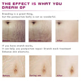 Stretch Marks Remover Essential Oil Eliminate Pregnancy Scars Maternity Repair Anti Winkle Skin Firming Treatment - Virtual Blue Store