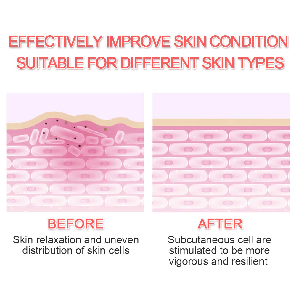 5 in 1 Face Massager LED Skin Tightening Mesotherapy Facial Skin Care Face Skin Rejuvenation Remover Wrinkle - Virtual Blue Store