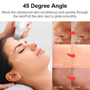 Ultrasonic Skin Scrubber Vibration Face Spatula Blackhead Remover Facial Scrubber Shovel Clean Cavitation Peeling Facial Lifting - Virtual Blue Store