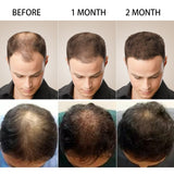Hair Loss Products Natural With No Side Effects Grow Hair Faster Regrowth Hair Growth Products - Virtual Blue Store