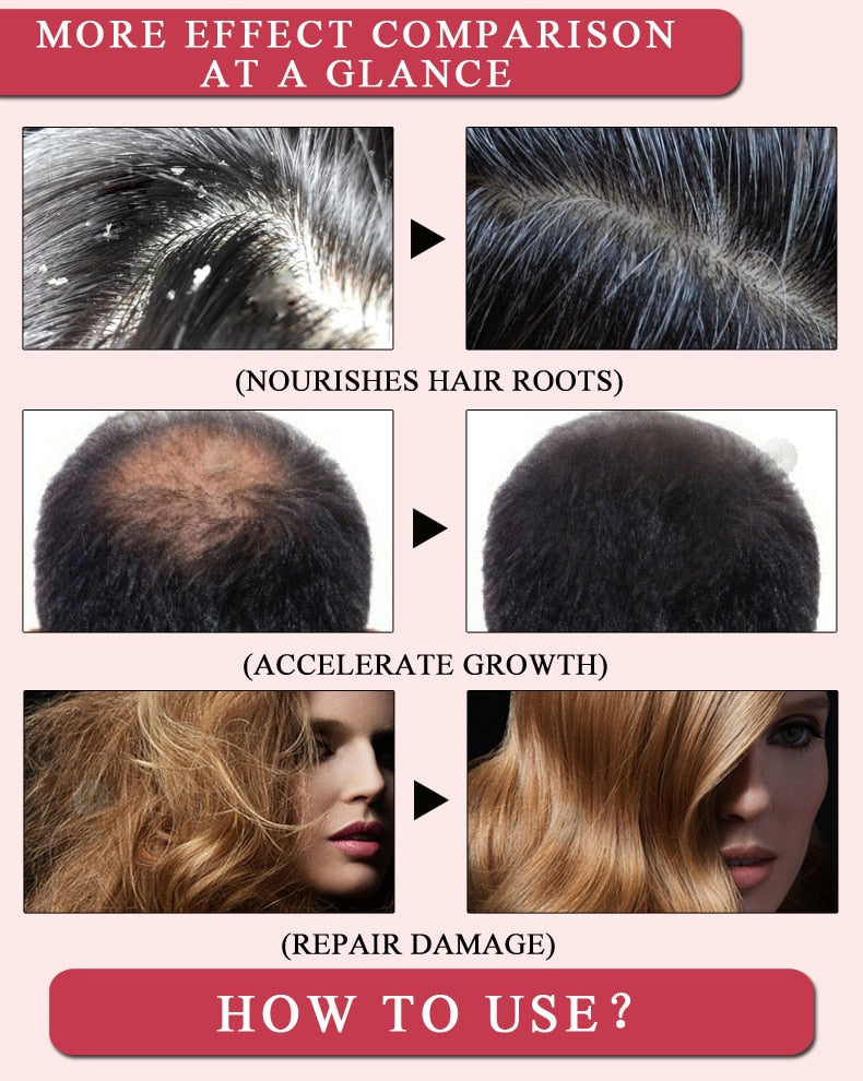 Hair Loss Products Natural With No Side Effects Grow Hair Faster Regrowth Hair Growth Products - Virtual Blue Store