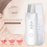 Ultrasonic Exfoliating Blackhead Remove Face Scrubber Vacuum Blemish Pimple Remover Pore Cleaning Tools Face Peeling Machine - Virtual Blue Store