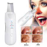 Ultrasonic Exfoliating Blackhead Remove Face Scrubber Vacuum Blemish Pimple Remover Pore Cleaning Tools Face Peeling Machine - Virtual Blue Store