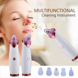 Ultrasonic Exfoliating Blackhead Remove Face Scrubber Vacuum Blemish Pimple Remover Pore Cleaning Tools Face Peeling Machine - Virtual Blue Store