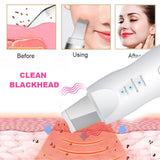 Ultrasonic Exfoliating Blackhead Remove Face Scrubber Vacuum Blemish Pimple Remover Pore Cleaning Tools Face Peeling Machine - Virtual Blue Store