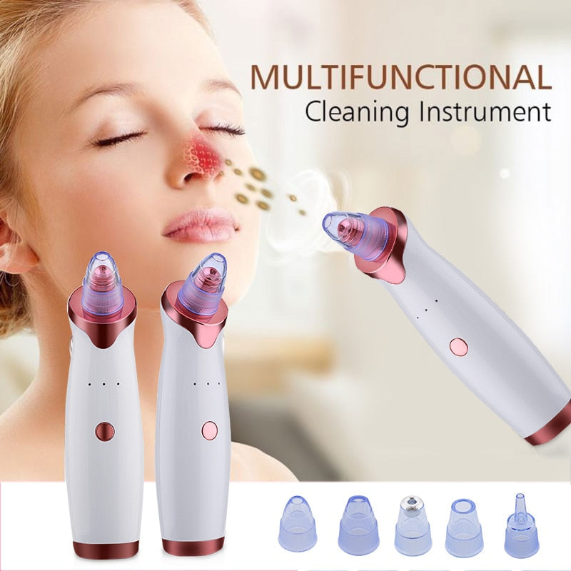 Ultrasonic Exfoliating Blackhead Remove Face Scrubber Vacuum Blemish Pimple Remover Pore Cleaning Tools Face Peeling Machine - Virtual Blue Store