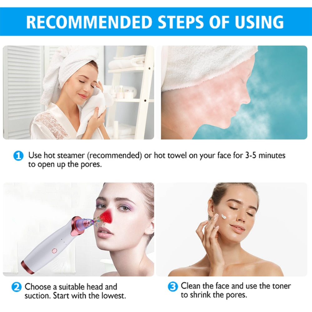 Ultrasonic Exfoliating Blackhead Remove Face Scrubber Vacuum Blemish Pimple Remover Pore Cleaning Tools Face Peeling Machine - Virtual Blue Store