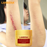 LANBENA Acne Scar Removal Cream Acne Spots Repair Acne Treatment Blackhead Whitening Stretch Marks Skin Care Bleaching Cream - Virtual Blue Store
