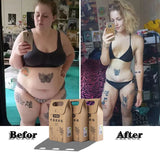 30pcs Chinese Medicine Slimming Diets Patch Weight Loss Strongest Slim Patch Pads Detox Adhesive Sheet Face Lift Tool - Virtual Blue Store