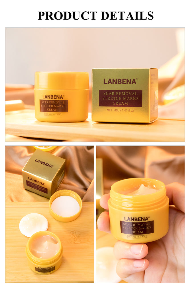 LANBENA Acne Scar Removal Cream Acne Spots Repair Acne Treatment Blackhead Whitening Stretch Marks Skin Care Bleaching Cream - Virtual Blue Store