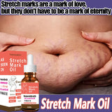 Stretch Marks Permanent Removal Oil Maternity Pregnant Women Pregnancy Anti-Winkle Smooth Repair Firming Skin Body Skin Care Cre