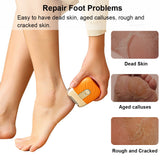 Electric Foot Grinder Mini Electric Foot Callus Remover USB Rechargeable Mini Electric Foot File Pedicure Tool Dead Skin Remover