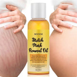 100ml Stretch Mark Removal Oil Removes Postpartum Pregnant Women Scar Repair Obesity Stretch Mark Anti-Aging Firming Serum Cream