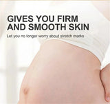 Stretch Marks Permanent Removal Oil Maternity Pregnant Women Pregnancy Anti-Winkle Smooth Repair Firming Skin Body Skin Care Cre