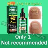 7 Days Nail Fungus Treatment Serum Ginger Anti-infective Paronychia Onychomycosis Toe Foot Nail Fungal Repair Gel Hand Foot Care