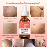 Stretch Marks Permanent Removal Oil Maternity Pregnant Women Pregnancy Anti-Winkle Smooth Repair Firming Skin Body Skin Care Cre