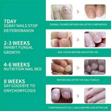 7 Days Nail Fungus Treatment Serum Ginger Anti-infective Paronychia Onychomycosis Toe Foot Nail Fungal Repair Gel Hand Foot Care