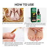 7 Days Fungal Nail Treatment Serum Foot Nail Fungus Removal Repair Gel Anti Infection Paronychia Onychomycosis Foot Nails Care