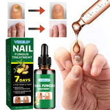 7 Days Nail Fungus Treatment Serum Ginger Anti-infective Paronychia Onychomycosis Toe Foot Nail Fungal Repair Gel Hand Foot Care