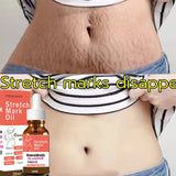 Stretch Marks Permanent Removal Oil Maternity Pregnant Women Pregnancy Anti-Winkle Smooth Repair Firming Skin Body Skin Care Cre
