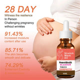 Stretch Marks Permanent Removal Oil Maternity Pregnant Women Pregnancy Anti-Winkle Smooth Repair Firming Skin Body Skin Care Cre