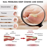 7 Days Nail Fungus Treatment Serum Ginger Anti-infective Paronychia Onychomycosis Toe Foot Nail Fungal Repair Gel Hand Foot Care