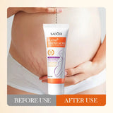 Stretch Marks Permanent Removal Oil Maternity Pregnant Women Pregnancy Anti-Winkle Smooth Repair Firming Skin Body Skin Care Cre