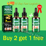 7 Days Nail Fungus Treatment Serum Ginger Anti-infective Paronychia Onychomycosis Toe Foot Nail Fungal Repair Gel Hand Foot Care