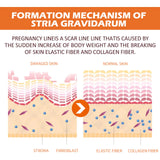 100ml Stretch Mark Removal Oil Removes Postpartum Pregnant Women Scar Repair Obesity Stretch Mark Anti-Aging Firming Serum Cream