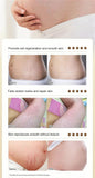Stretch Marks Permanent Removal Oil Maternity Pregnant Women Pregnancy Anti-Winkle Smooth Repair Firming Skin Body Skin Care Cre