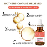 Stretch Marks Permanent Removal Oil Maternity Pregnant Women Pregnancy Anti-Winkle Smooth Repair Firming Skin Body Skin Care Cre