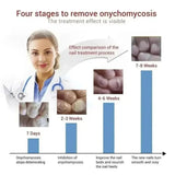 7 Days Nail Fungus Treatment Serum Ginger Anti-infective Paronychia Onychomycosis Toe Foot Nail Fungal Repair Gel Hand Foot Care