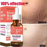 Stretch Marks Permanent Removal Oil Maternity Pregnant Women Pregnancy Anti-Winkle Smooth Repair Firming Skin Body Skin Care Cre