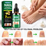 7 Days Nail Fungus Treatment Serum Ginger Anti-infective Paronychia Onychomycosis Toe Foot Nail Fungal Repair Gel Hand Foot Care