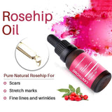 Pure Organic Rosehip Oil Antioxidantfor Scars Fine Lines Wrinkles Stretch Marks Improve Skin Elasticity Firmness - Virtual Blue Store