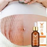 Stretch Marks Remover Essential Oil Eliminate Pregnancy Scars Maternity Repair Anti Winkle Skin Firming Treatment