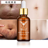 Stretch Marks Remover Essential Oil Eliminate Pregnancy Scars Maternity Repair Anti Winkle Skin Firming Treatment - Virtual Blue Store