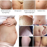Stretch Marks Remover Essential Oil Eliminate Pregnancy Scars Maternity Repair Anti Winkle Skin Firming Treatment - Virtual Blue Store