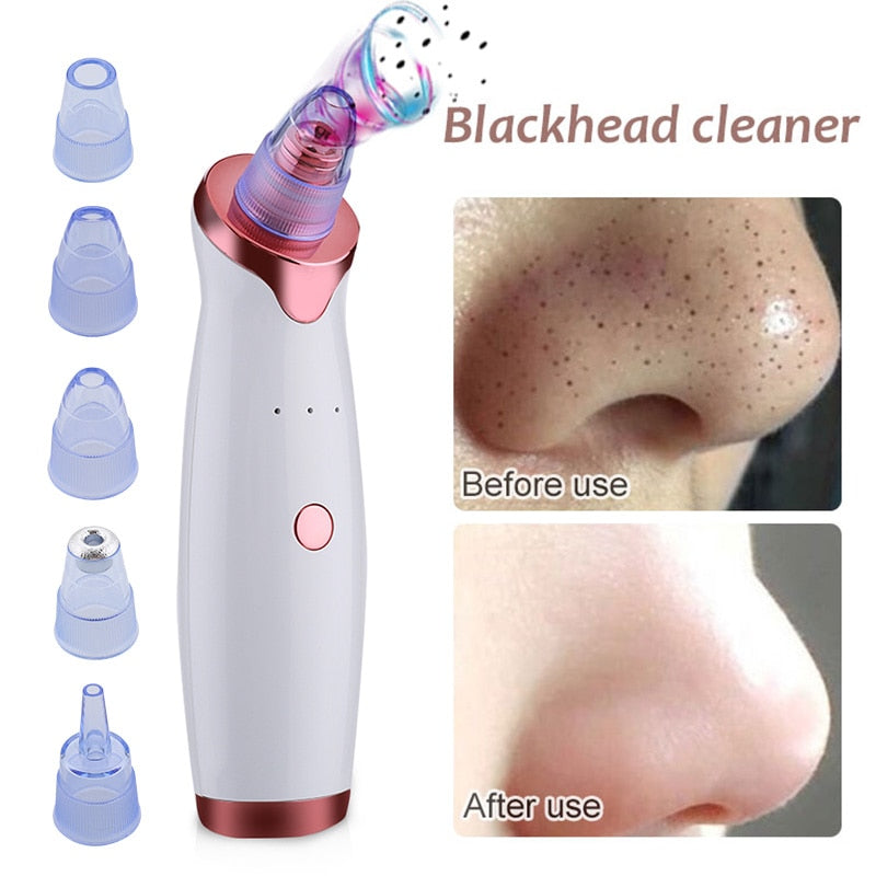 Ultrasonic Exfoliating Blackhead Remove Face Scrubber Vacuum Blemish Pimple Remover Pore Cleaning Tools Face Peeling Machine - Virtual Blue Store