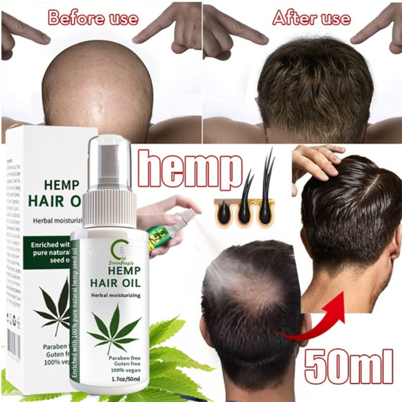GPGP Greenpeople 30Days Hemp Hair Growth Spray 50ml Fast Grow Ginger Hair Essence Hair Treatment Preventing Hair Loss Spray - Virtual Blue Store