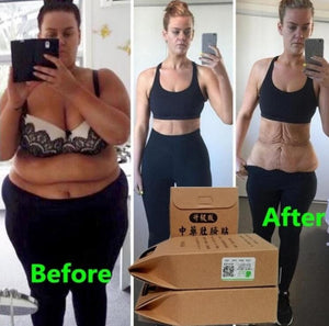 100pcs Chinese Medicine Slimming Patch Lift Lose Weight Strongest Slim Patch Pads Detox Adhesive Anti Cellulite Face Lift Tool - Virtual Blue Store